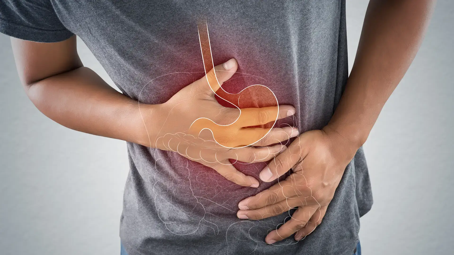 Síndrome del intestino irritable en preguntas y respuestas: causas, síntomas y tratamiento del SII
